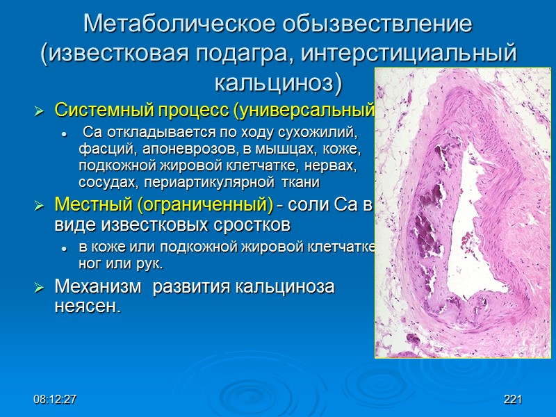 08:12:02 Метаболическое обызвествление (известковая подагра, интерстициальный кальциноз) Системный процесс (универсальный),  Са откладывается по